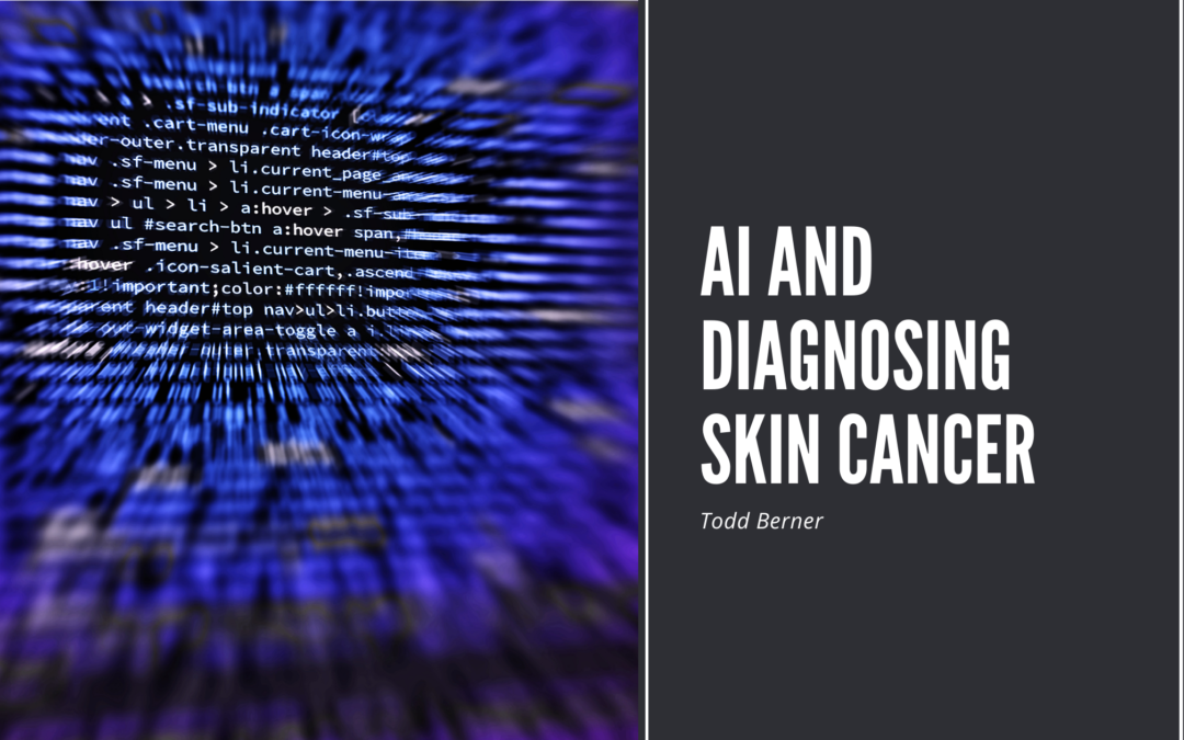 AI and Diagnosing Skin Cancer